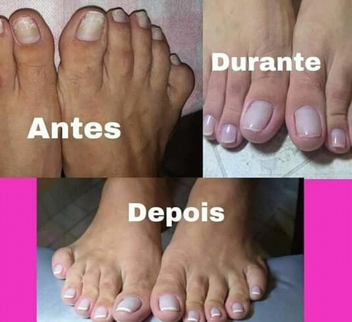 Imagem 2 de 5 de Manicure,pedicure E Spar Dos Pes. Atendimento Domiciliár