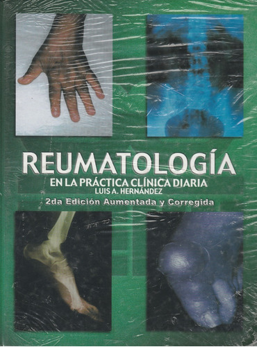 Reumatología En La Practica Clinica Diaria Dr Luis Hernandez