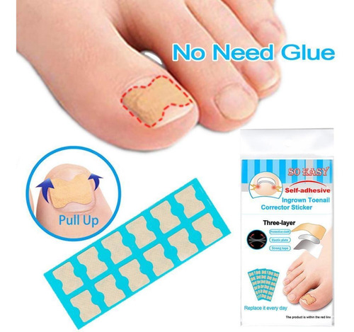 Tiras De Pegatinas De Corrección De Uñas Kit De 120 Hojas