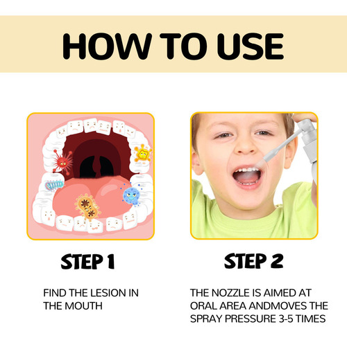 Aerosol Dental For El Cuidado De Niños, Anticaries, Reparad