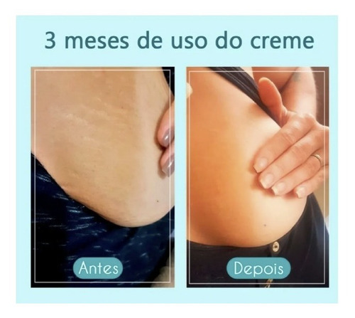 Imagem 7 de 10 de Kit Creme Cicatribem 150g + Esfoliante 120g Tira Estrias