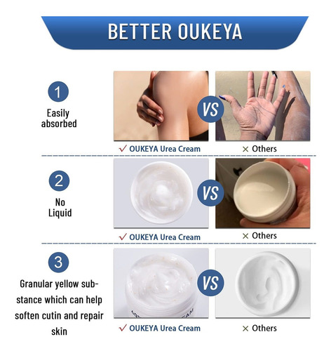 Oukeya Crema De Urea 40 Por Ciento, Crema De Urea Para Pies