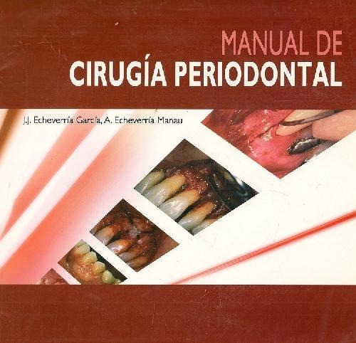 Libro Manual De Cirugia Periodontal De J.j. Echeverria Garci