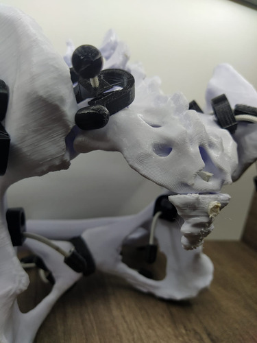 Pelvis Femenina Articulada Con Vertebra L4