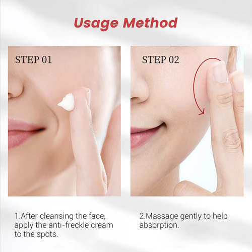 Crema Blanqueadora De Pecas Para Eliminar Manchas Oscuras, 2