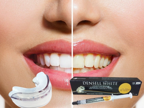 Blanqueamiento Dental Dientes Blancos Blanqueador Agnovedade