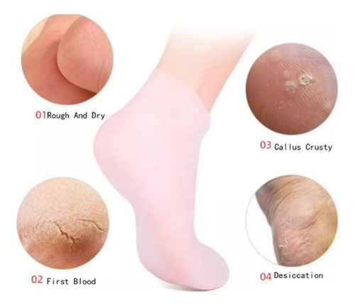 Calcetines De Silicona Hidratantes Para Piel Seca Y Pies