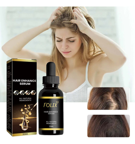 S Hair Growth Formula, Hair Growth Serum,hair Growth Oi 1011