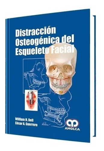 Distracción Osteogénica Del Esqueleto Facial.