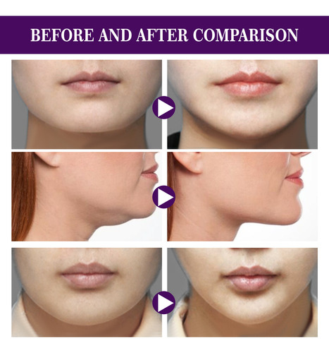 Cinta De Estiramiento Facial Instantánea J Face Lift Tape, D