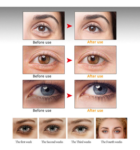 Crema Para Ojos Peptide Golden Face + + Snail Roller Artisca