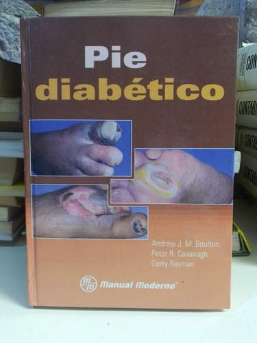 Pie Diabético  Andrew J. M. Boulton/peter R. Cavanagh/reyman