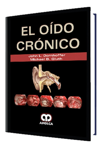 El Oído Crónico El Libro Perfecto Para Otorrinolaringólogos