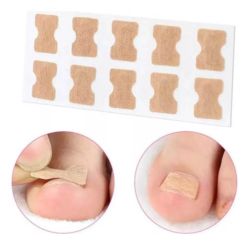 50 Parches Correctores Uñas Enterradas Uñeros Adhesivos