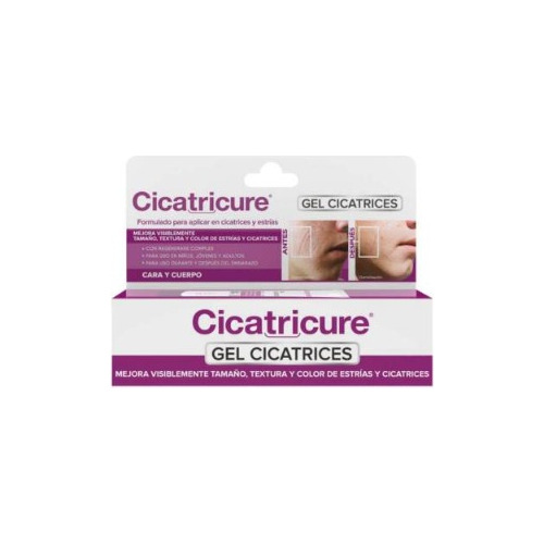 Cicatricure Gel Cicatrices Y Estrías 30g