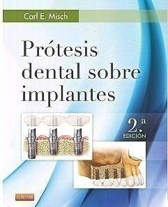 Prótesis Dental Sobre Implantes - Misch, Carl E. (pa