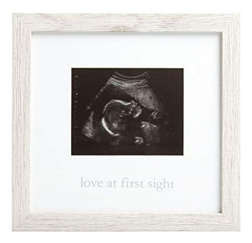 Kate Y Milo, Marco R Stico Sonogram Love At First Sight