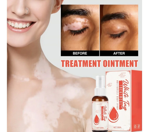 White Tag Spray Tratamiento Facial Corporal Vitiligo 50 Ml Neutra