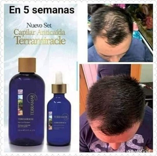 Set Anti Caída Shampoo Y Tratamiento Terramar + Gel