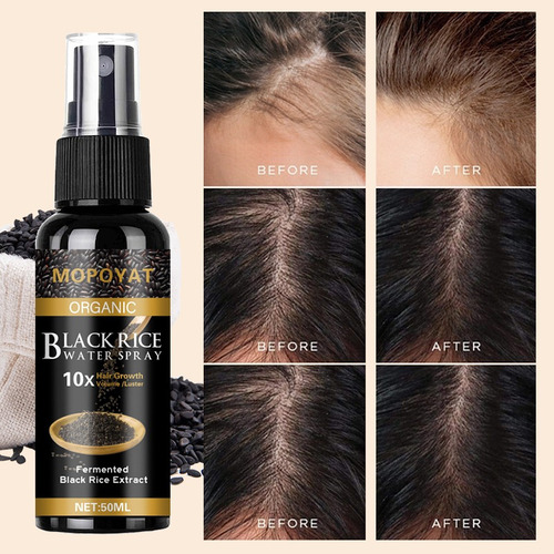 Fl 2pcs Loción Capilar Spray Cabello Y Barba Nutre Hidrata