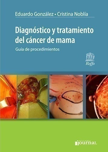 Diagnóstico Y Tratamiento Del Cáncer De Mama - González, Ed