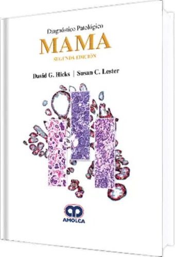 Diagnóstico Patológico Mama. 2 Edición