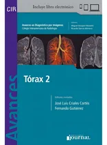 Comprar Torax 2 Avances En Diagnostico Por Imagen