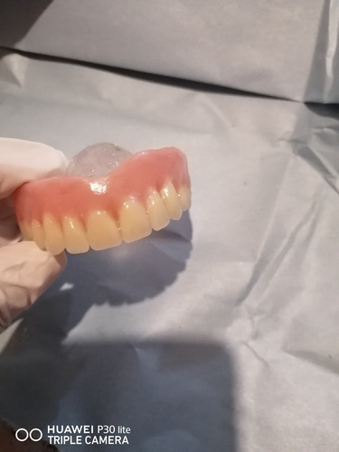 Imagen 3 de 5 de Prótesis Dentales, Reparaciones, Laboratorio Odontológico