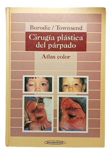 Cirugía Plástica De Párpado - Borodic Y Townsend - Panameric