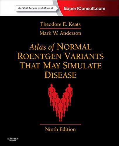 Libro Atlas Of Normal Roentgen Variants That May Simulate Di