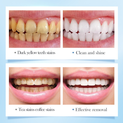 Pasta De Dientes No Blanqueadora Y Quitamanchas Oral White T