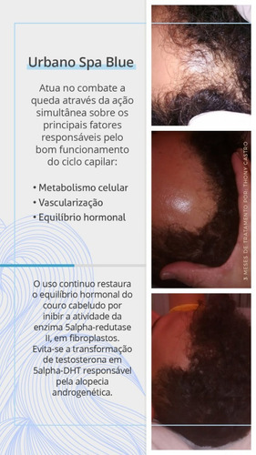 Kit Grandha Queda E Crescimento Urbano Spa Blue E Spa Black