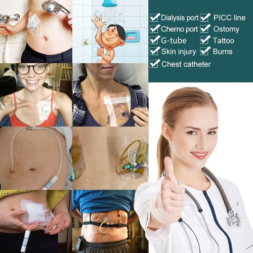 Cubierta De Ducha Para Catéter De Diálisis Peritoneal, Prote