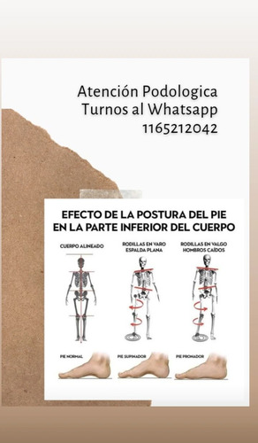 Imagen 3 de 5 de Podologa ,pedicura A Domicilio.