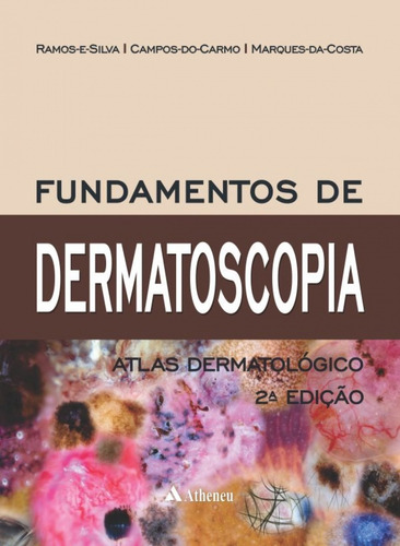 Fundamentos de Dermatoscopia, de Ramos-e-Silva, Marcia. Editora Atheneu Ltda, capa dura em português, 2016