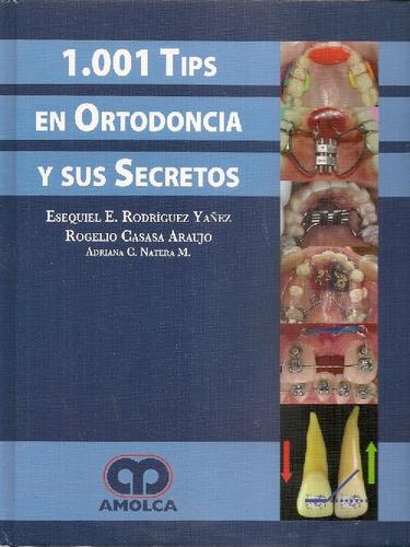 Libro 1001 Tips En Ortodoncia Y Sus Secretos De Esequiel Edu