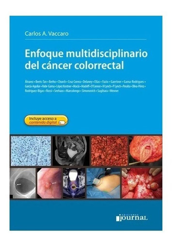 Enfoque Multidisciplinario Del Cancer Colorectal