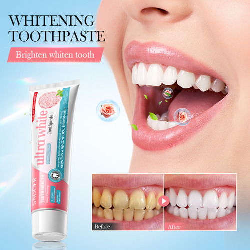 Pasta De Dientes Blanqueadora Y Quitamanchas T Rose Oral Whi