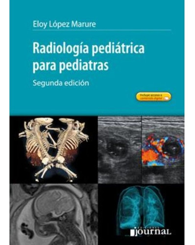 Radiologia Pediatrica Para Pediatras Lopez Marure