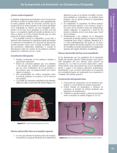De La Impresión A La Activación En Ortodoncia Y Ortopedia. 2ª Edición. Incluye E-book, De Esequiel Rodríguez., Vol. 1. Editorial Amolca, Tapa Dura, Edición 2 En Español, 2024