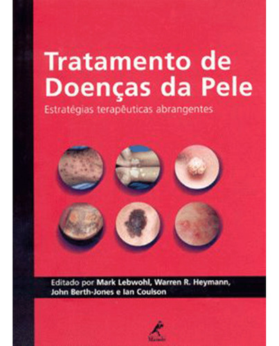 Tratamento de doenças da pele: Estratégias Terapêuticas Abrangentes, de Lebwohl, Mark. Editora Manole LTDA, capa mole em português, 1994