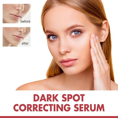 Suero Corrector De Manchas Oscuras Con Niacinamida