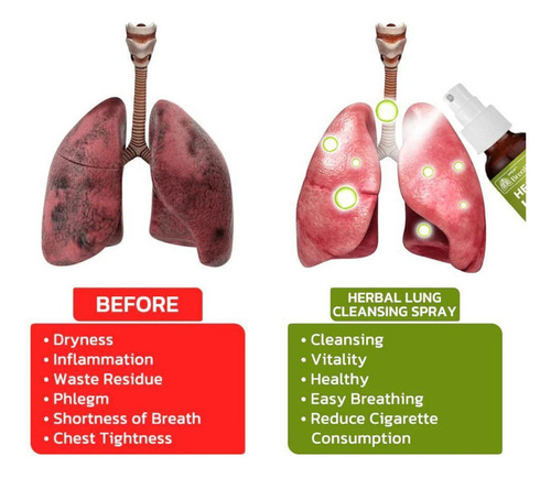 2 Breathdetox Spray Limpiador Pulmonar A Base De Hierbas