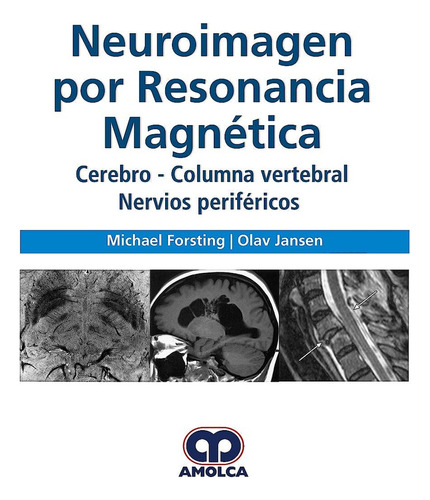 Neuroimagen Por Resonancia Magnética - Forsting, Michael