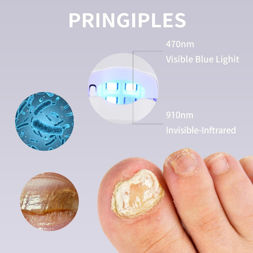 Dispositivo De Limpieza Con Luz Para Hongos En Las Uñas Weil