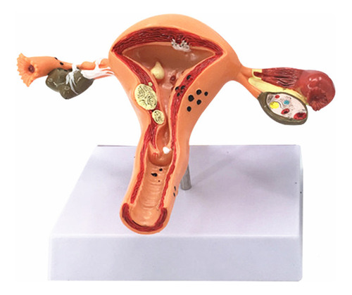 Modelo Anatómico Del Útero Reproductor Femenino