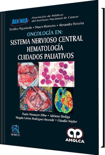 Oncología En Sistema Nervioso Central Hematología Cuidados