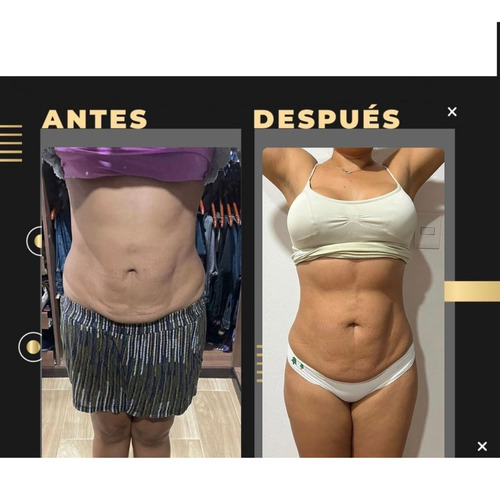 Reafirma Y Elimina La Flacidez Loción Reafirmante