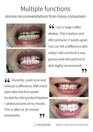 2 Unidades De Pasta De Dientes Blanqueadora En Espuma Blanqu