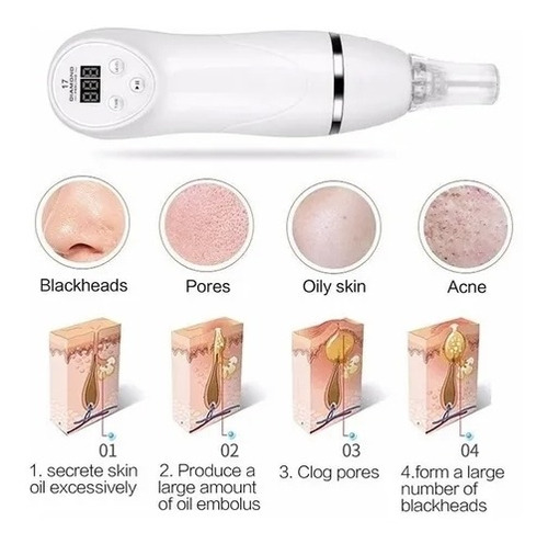 Acné Espinilla De Succión Microdermoabrasión Blackhead Instr